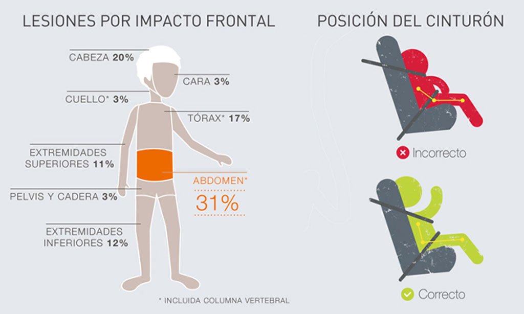 Gráfico-protección-sillita-SecureGuard